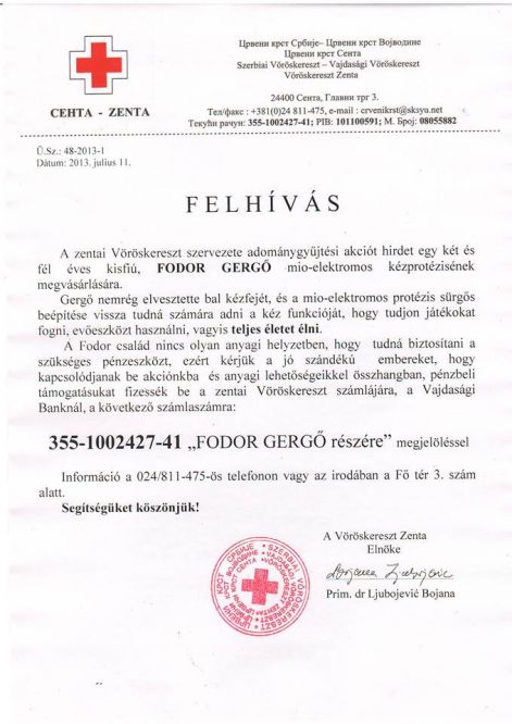 fodor_gergo_mio_el.kezprotezis.jpg
